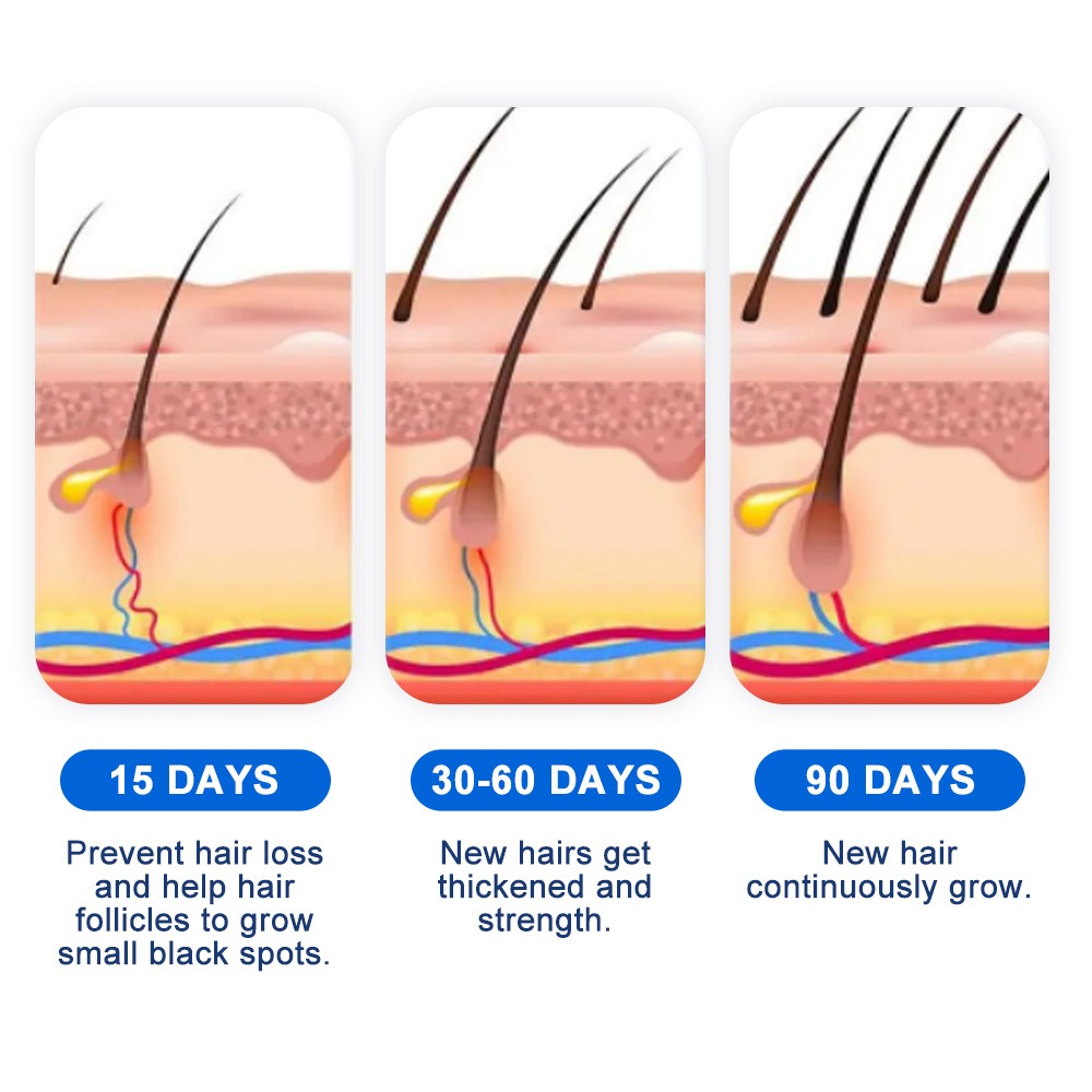 Alopesi Saç Çıkarma Spreyi Sop - Hair Care For Hair Growth incelemesi ve fiyatı