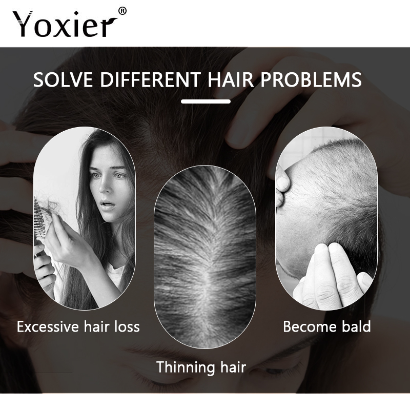 Yoğun büyüme serumu önlemek sa - Hair Care For Hair Growth incelemesi ve fiyatı
