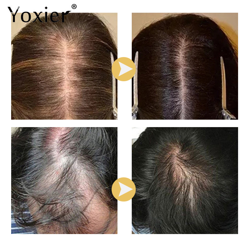 Yoğun büyüme serumu önlemek sa - Hair Care For Hair Growth incelemesi ve fiyatı