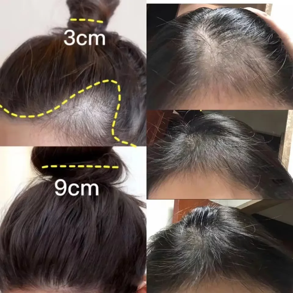 Hızlı Zencefil Saç Büyüme Krem - Hair Care Dupes incelemesi ve fiyatı