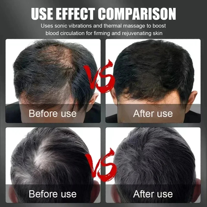 660nm 850nm Kırmızı Işık Kızıl - Hair Care For Hair Growth incelemesi ve fiyatı